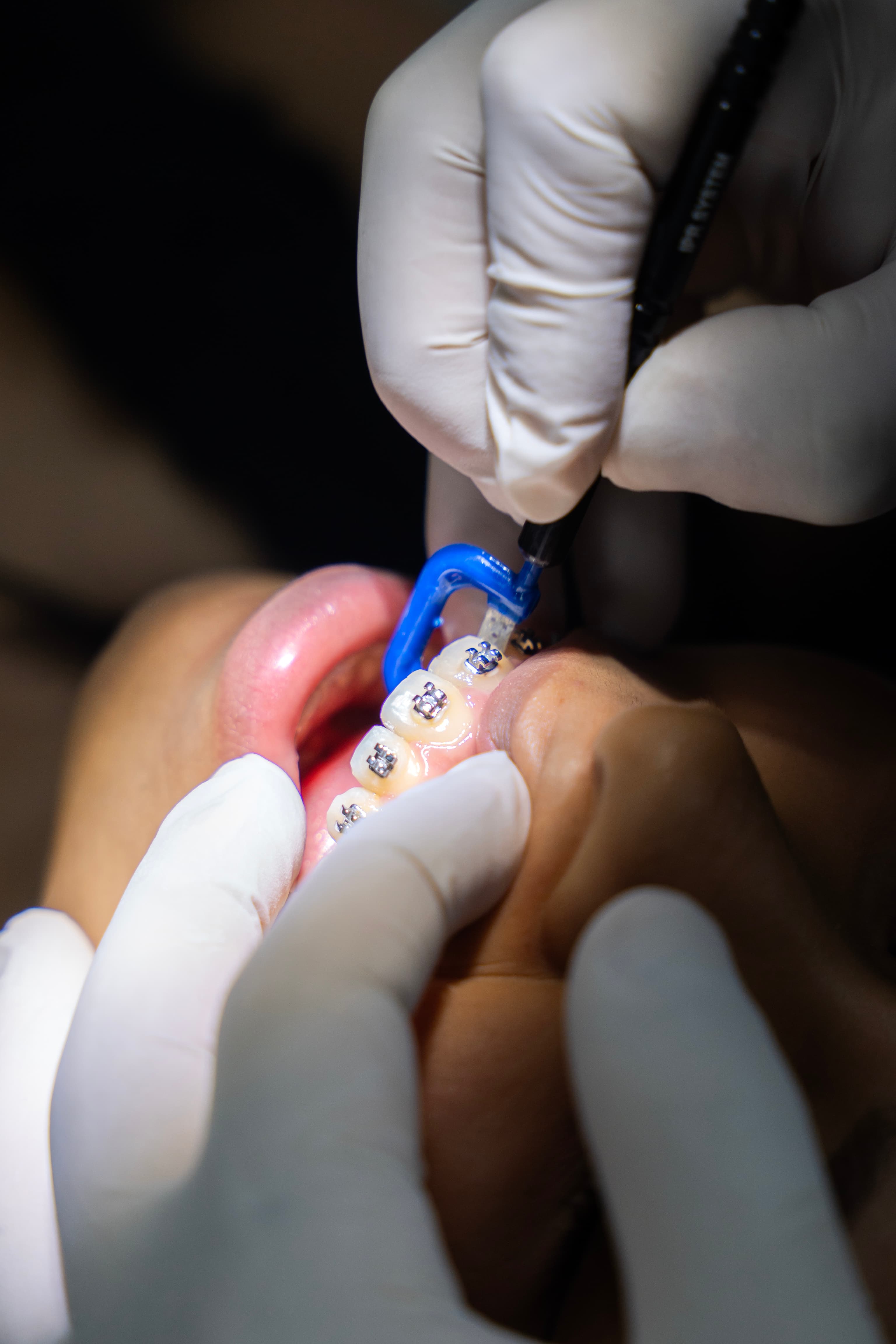 Consultorio Dental 1 — Clínica Dental Odonto Smart Lima