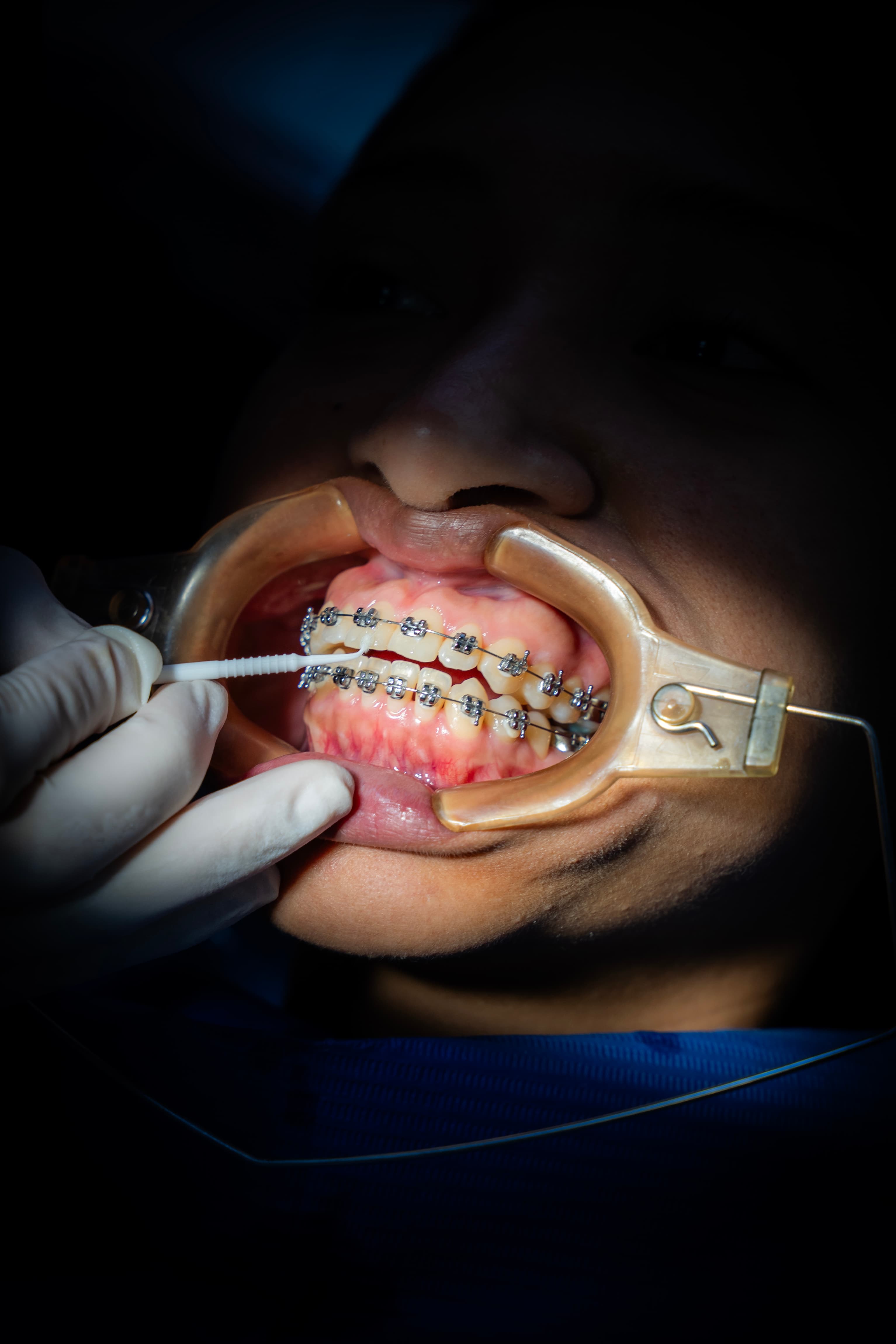Equipo Administrativo Atencion — Clínica Dental Odonto Smart Lima