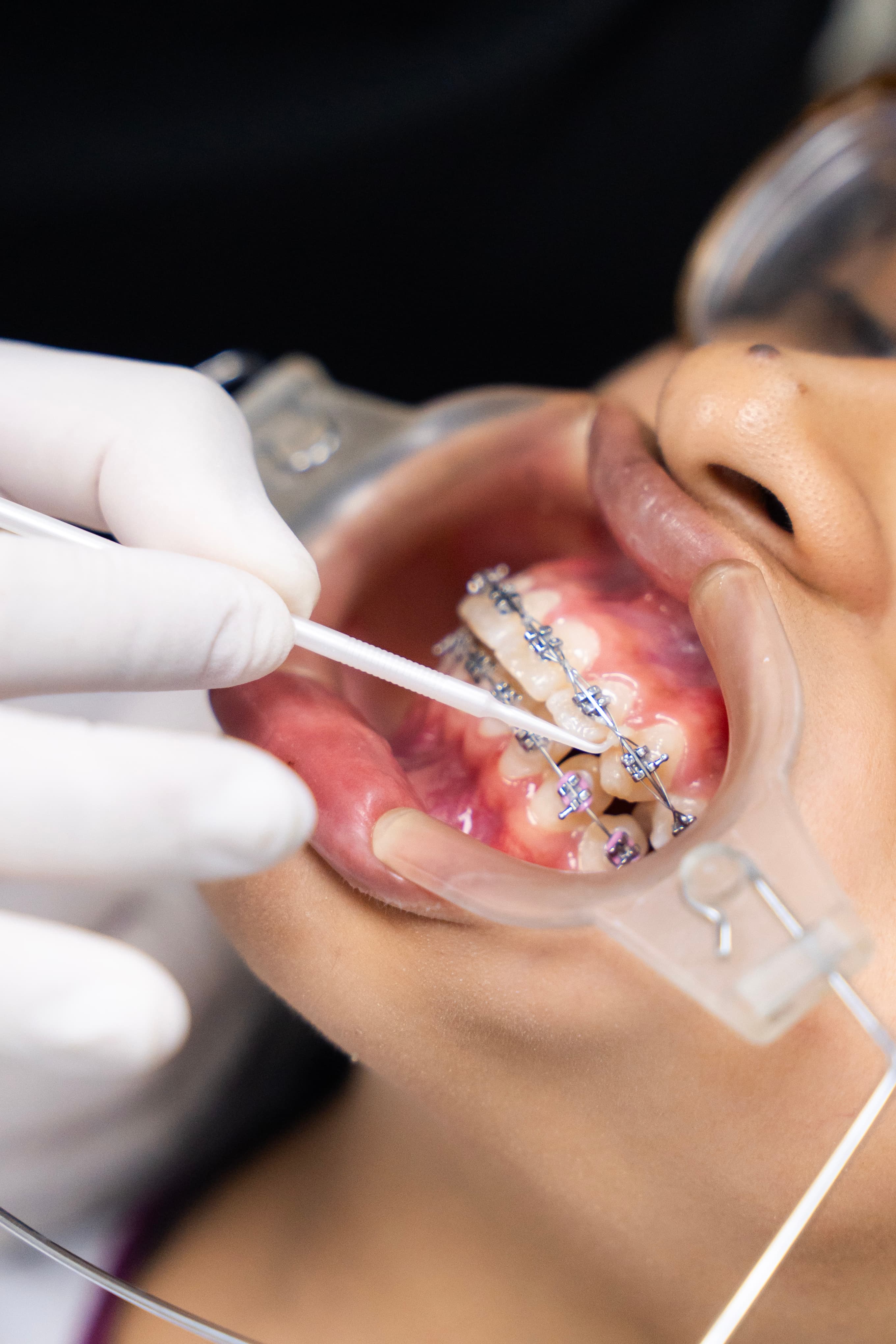 Especialista Odontologia Estetica — Clínica Dental Odonto Smart Lima